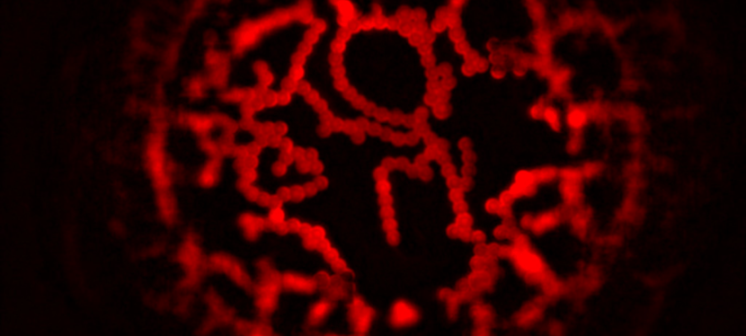 Keith Haring at the colloidal scale and dynamic&nbsp;capillarity